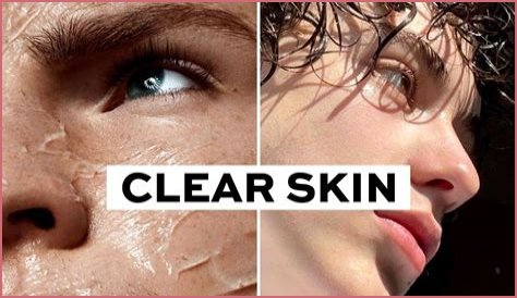 Do models need to have clear skin?