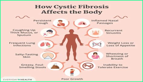 What is Fibrositis pain?